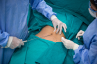 Lipo 360 Near Me