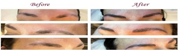 Arizona Studio of Electrolysis & Permanent Makeup