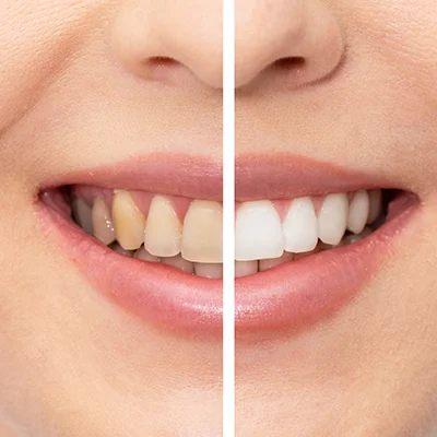 Best Dental clinic near me