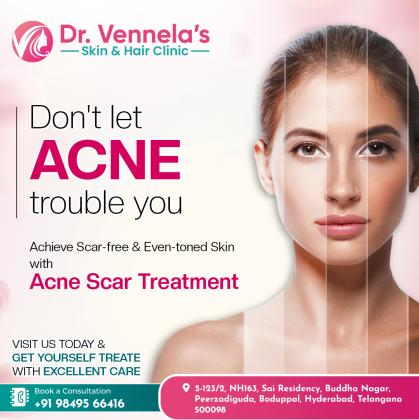 Laser Hair Removal Clinic in Hyderabad | Laser Skin Treatment in Hyderabad