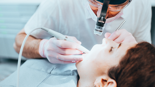 Tooth-Colored Fillings