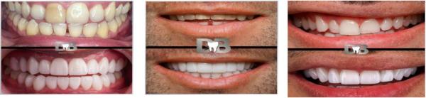 DB Dental Care