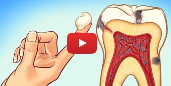Discover How to Banish Bad Breath, Tooth Decay & More!