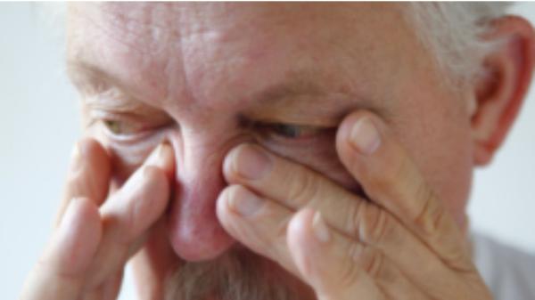 Fracture Of Nasal Bones