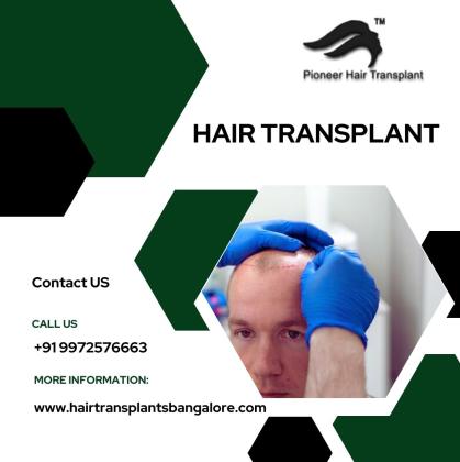 Hair Transplant Clinics in Bangalore | Hair Transplant Cost