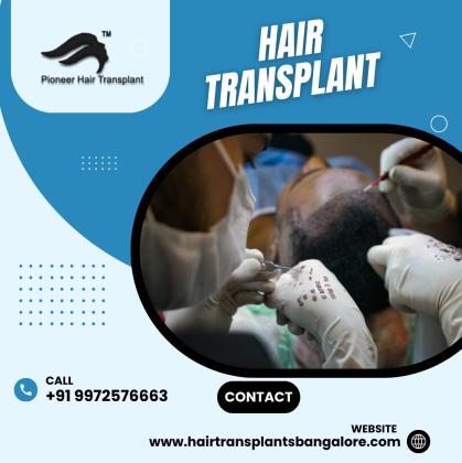 Hair Transplant Clinics in Bangalore | Hair Transplant Cost
