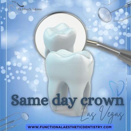 Same-Day Crowns  in Las Vegas at Functional Aesthetic Dentistry