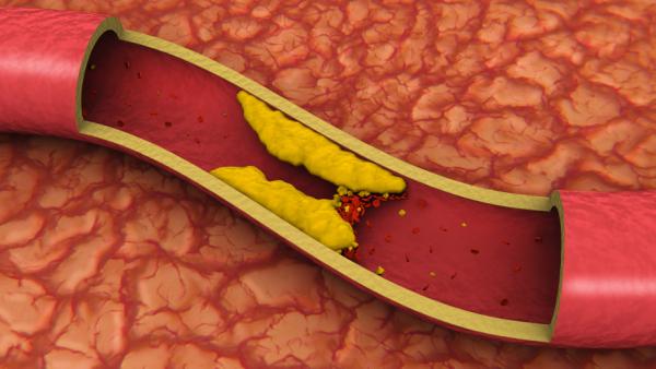 Seed Oils are Killing Us. Things You Need to Know!