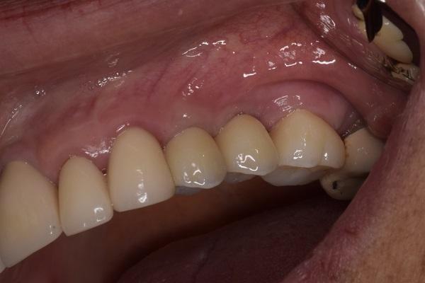 Transform your smile and appeal with steadfast Cosmetic dentist in Tijuana