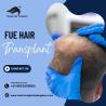 Best FUE Hair Transplant in Bangalore | FUE Hair Transplant Cost