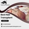 Best Hair Transplant in Bangalore | Hair Transplant Clinic