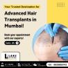 Best Hair Transplant Surgeon in Mumbai - Larz Clinic