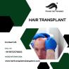 Hair Transplant Clinics in Bangalore | Hair Transplant Cost
