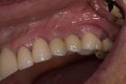 Transform your smile and appeal with steadfast Cosmetic dentist in Tijuana