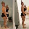 Weight loss injections cost