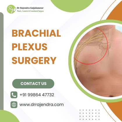 Brachial Plexus Surgery - Top Plastic Surgeon Of Bangalore