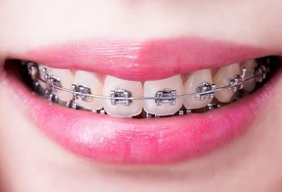 Cool SmilesZ
