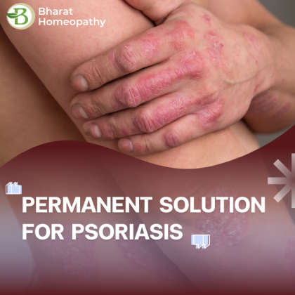Homeopathy for Psoriasis: A Permanent Solution or Just a Myth?