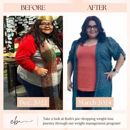 Know the importance of Tirzepatide weight loss injections in Brownsville