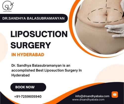 Transform Your Body with Expert Liposuction Surgery in Hyderabad