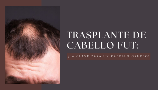 Trasplante de cabello FUT: ¡la clave para un cabello grueso!