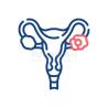 Best Ovarian Cancer Treatment Hospitals in Hyderabad