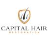 Capital Hair Restoration - Hair Transplant