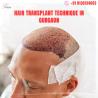 Hair Transplant Technique In Gurgaon | Book Your Appointment Now