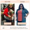 Know the importance of Tirzepatide weight loss injections in Brownsville