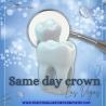 Same-Day Crowns  in Las Vegas at Functional Aesthetic Dentistry