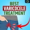 Varicocele: Causes, Symptoms, and Natural Remedies for Relief