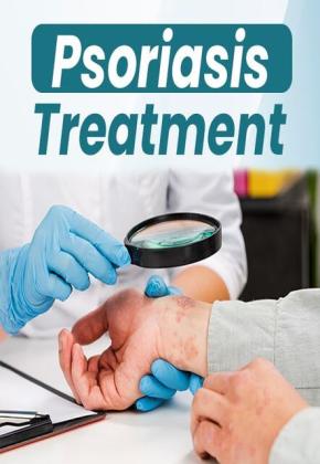 7 Powerful Natural Remedies to Treat Scalp Psoriasis at Home