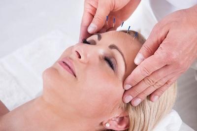 Acupuncture Stem Cell