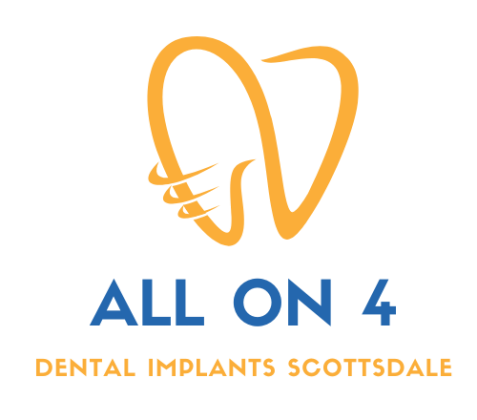 All-on-4 Dental Implants Scottsdale