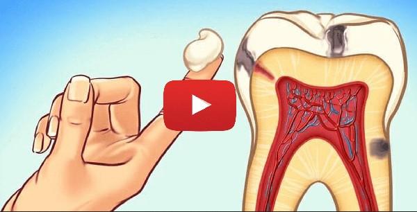 Banish Bad Breath Fast with This Bizarre Spice Ritual