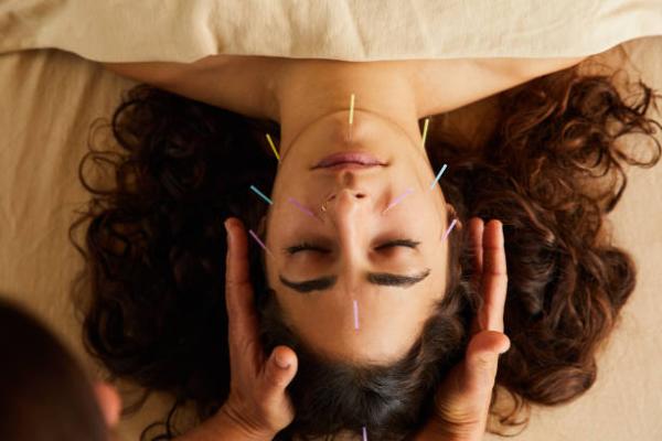 Best Dry Needling Acupuncture in London
