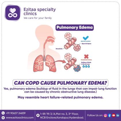 Best Pulmonology Clinic in Kondapur, Hyderabad – Ezitaa Specialty Clinics
