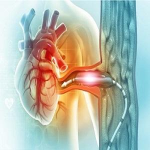 CardioCare Heart & Vascular Center/ Emilio Garcia, MD