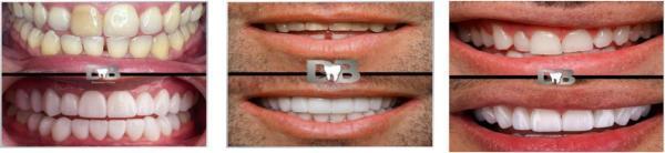 DB Dental Care