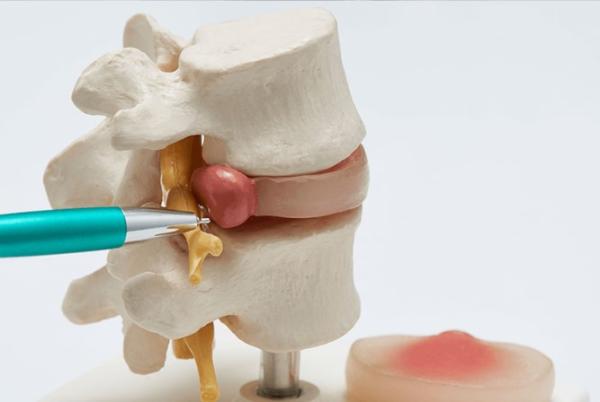 Pain Management Glenn Dale