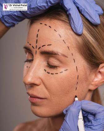 Transform Your Look with Expert Facelift Surgery in Mumbai