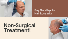 Say Goodbye to Hair Loss with Non-Surgical Treatment!