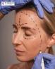 Transform Your Look with Expert Facelift Surgery in Mumbai