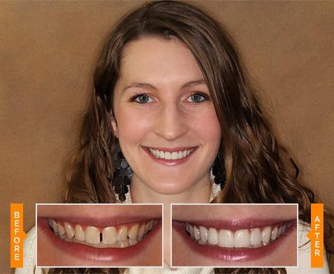 Affordable Cosmetic Dentistry in Ohio – Smile Confidently with Dublin Metro Dental