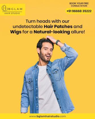 Best Hair Patch in Bangalore | Hair Patches for Men and Women