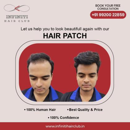 Best hair patch services in Mumbai for men and women Infiniti