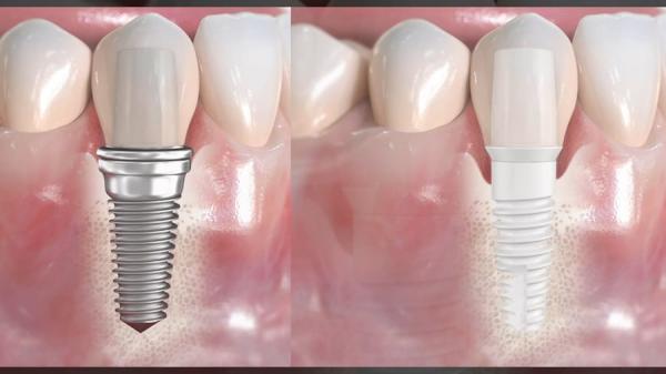 Newport Beach Dental Health and Wellness