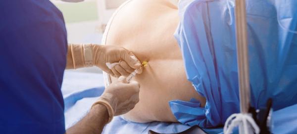 Pain Management Silver Spring