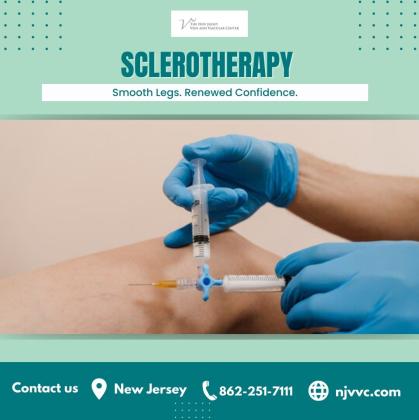 Sclerotherapy NJ