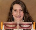 Affordable Cosmetic Dentistry in Ohio – Smile Confidently with Dublin Metro Dental